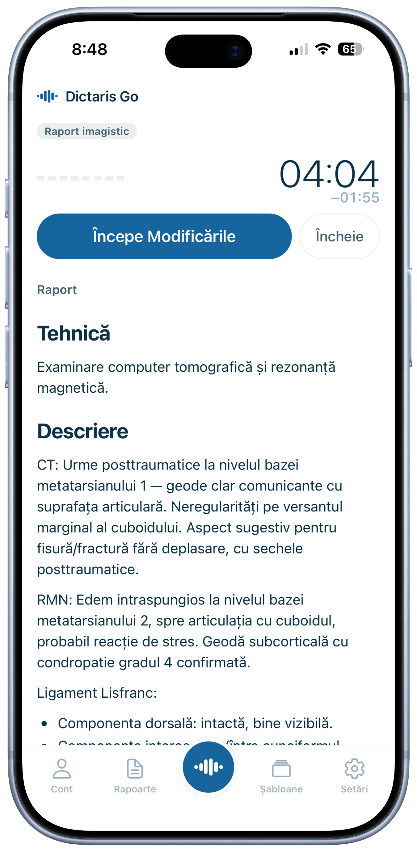 Dictaris Go pe iPhone
